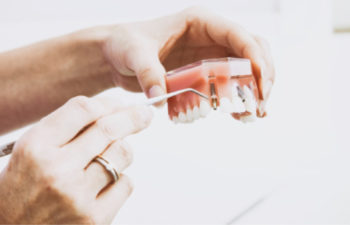 hands demonstrating dental implants model