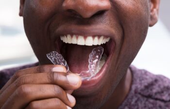 Invisalign for Adults: What Changes Fastest in the First 90 Days Mooresville, NC