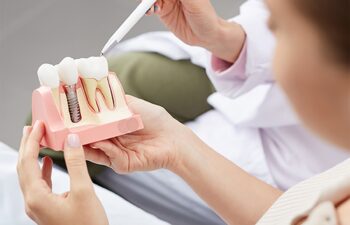Dental Implants in Mooresville & Troutman: What Makes Someone a Good Candidate? Mooresville, NC